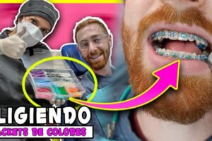 Brackets de colores: La nueva tendencia para hombres