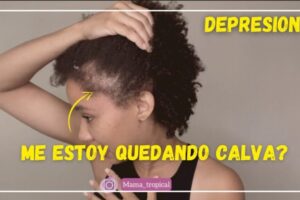 Señales para detectar la calvicie en mujeres