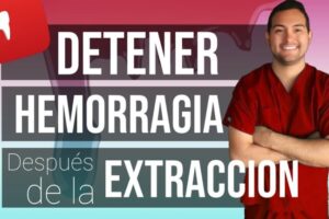 5 formas efectivas de detener el sangrado después de una extracción dental