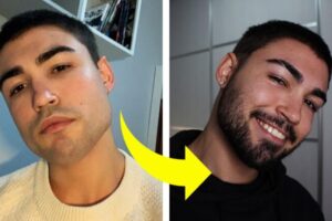 La mejor crema para un crecimiento rápido de la barba